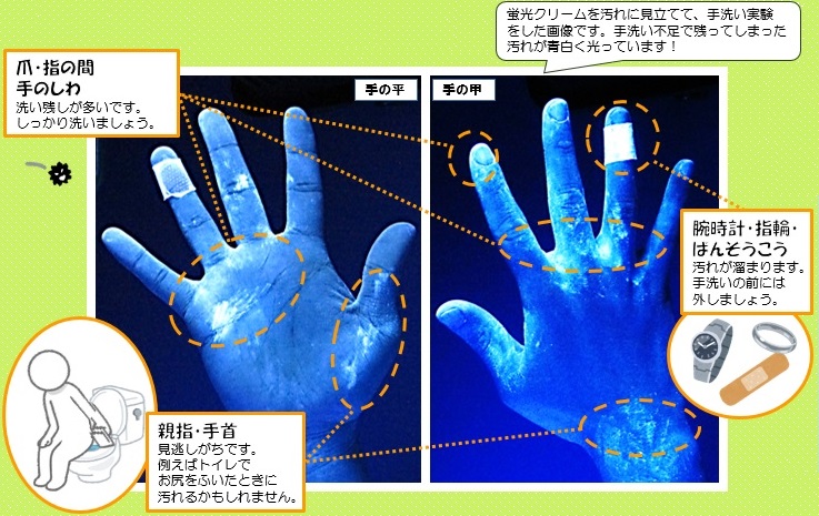 手の汚れている場所はどこ？