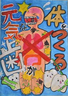 歯科医師会賞作品