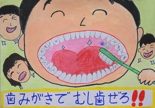 歯科医師会賞作品