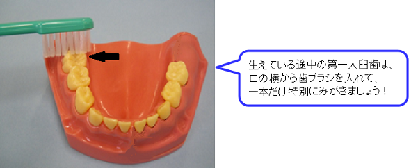 生えている途中の第一大臼歯は、口の横から歯ブラシを入れて、一本だけ特別にみがきましょう！