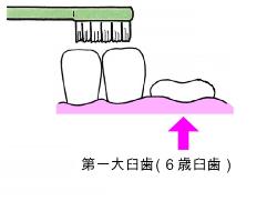 第一大臼歯の生えはじめのイラスト