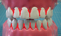 歯と歯の間の写真