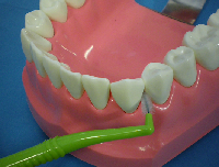 歯間ブラシの入れ方の写真