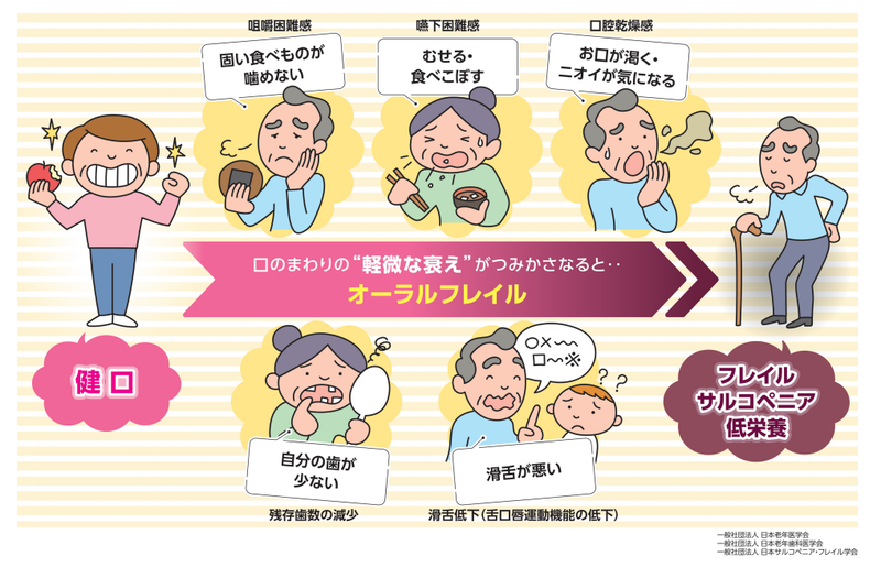 オーラルフレイル概念図